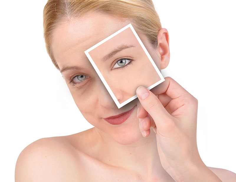 Caring for the skin around your eyes